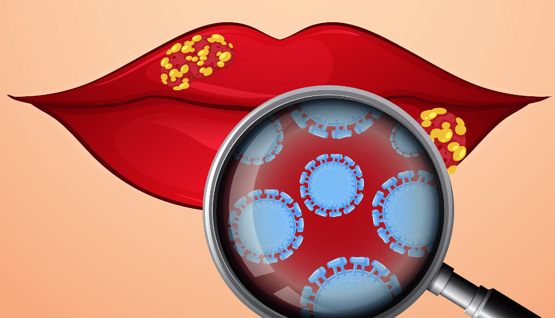 九游中国-猛龙队队员集体感染病毒，赛程受影响